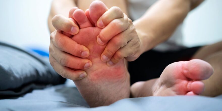 homeopathic medicine for high uric acid