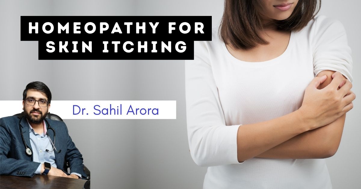 homeopathy for skin itching